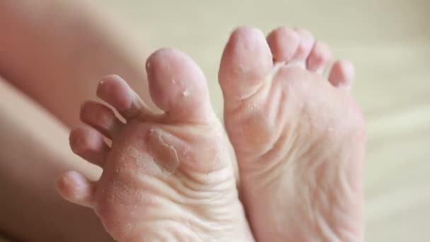 Pieds féminins avec peau décollée. gommage des pieds après la procédure — Video