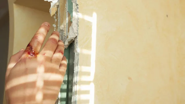 Lesão no trabalho. Reparador homem ferido o dedo durante a renovação do apartamento — Fotografia de Stock