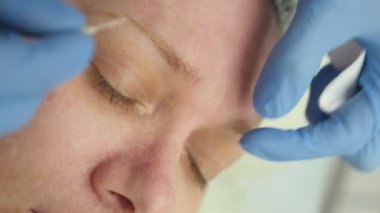 Yakın plan güzellik uzmanı bir kadının yüzündeki sivilceleri iğneyle temizler.