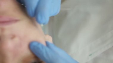 Yakın plan güzellik uzmanı bir kadının yüzündeki sivilceleri iğneyle temizler.