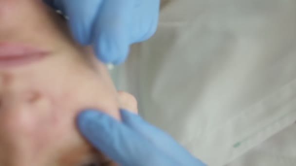 Nahaufnahme Kosmetikerin entfernt Akne auf einem Frauengesicht mit einer Nadel — Stockvideo