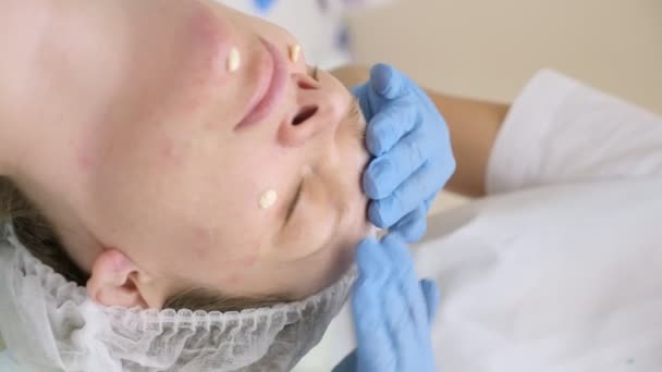 Close-up. as mãos de um esteticista em luvas de borracha aplicam creme no rosto de uma paciente do sexo feminino — Vídeo de Stock