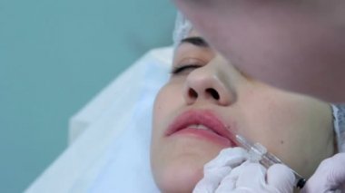 Dudak enjeksiyon plastik cerrahi. Closeup üst dudak