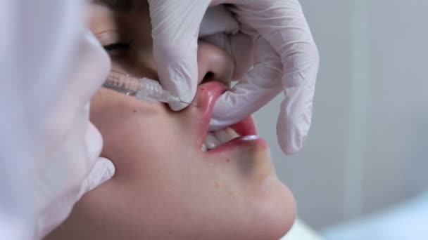 Injection de lèvre chirurgie plastique. Gros plan — Video