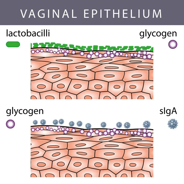 Epitelio vaginal con glucógeno — Vector de stock