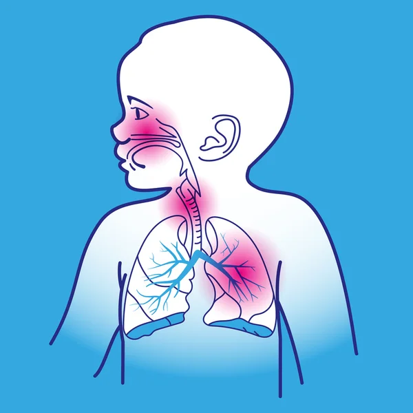 Esquema respiratorio infantil — Archivo Imágenes Vectoriales