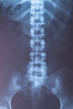 insan bir tıbbi tanı için x-ray görüntüsü