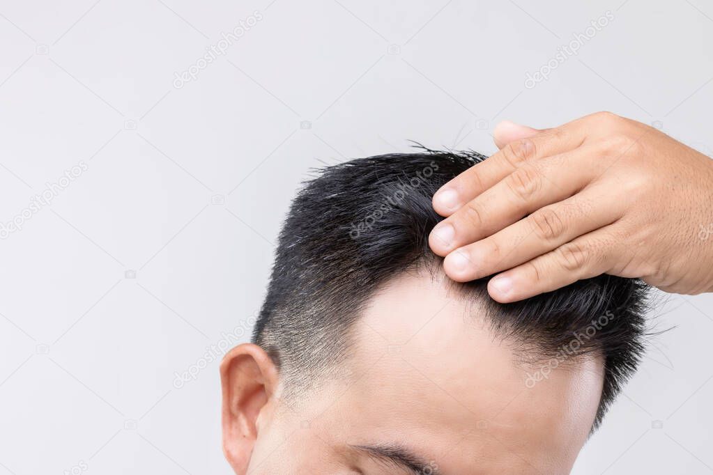 Portrait Asian man with worry feeling and touching on his head to show bald head or Glabrous problem. Studio shoot with copy space with grey background