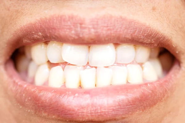 Woman mount and teeth — Stock Photo, Image