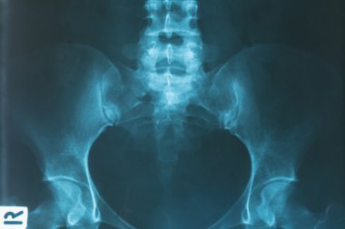 x-ray görüntü insan