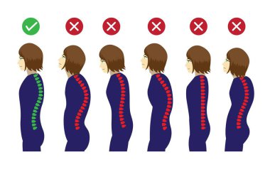 İyi Duruş X-Ray Manga Kadın Çizgi Filmi Vektör İllüstrasyonu