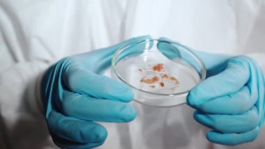 Steril petri kabının yakın çekimleri önde gelen laboratuvar çalışanlarının ellerinde mikrobiyolog enfekte olmuş hastaların mikroorganizmalarını araştırıyor. Analiz için alınan mantar dokuları, laboratuvar deneyleri...