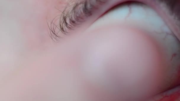 Człowiek z krótkowzrocznością zakłada soczewkę kontaktową na oko.. — Wideo stockowe