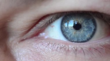 Erkek gözü çok büyüktür. Görüş yanıp sönüyor ve fırtınalar kopuyor.. 