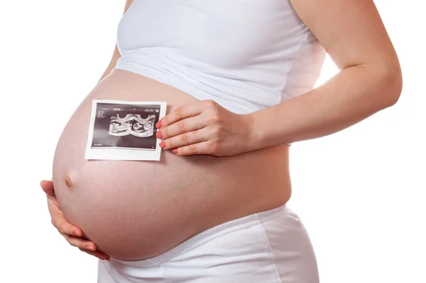 Беременная женщина проводит ультразвуковое сканирование своего ребенка — стоковое фото
