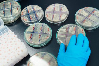 Doktor Petri Çanağından Örnek Alıyor