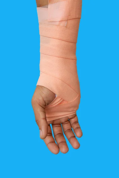 Arm Patient Accident Needs Splint Isolated Blue Background Clipping Path — Stock Photo, Image