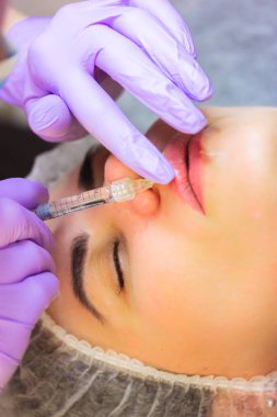 Dudak büyütme prosedürü. Güzel bir hasta kadın doldurma iğnesi yaptırıyor, botoks yaptırıyor. Güzellik uzmanı şırıngayla kolajen, hiyalüronik asit ve silikon enjekte eder. Mor eldiven giyen bir kozmetikçi.