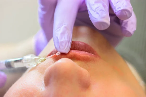 A cosmetologist injects a hyaluronic acid-based filler into the patient\'s lips. The process of lip augmentation in a young beautiful woman. A nurse is wearing purple rubber gloves. Beauty injections.