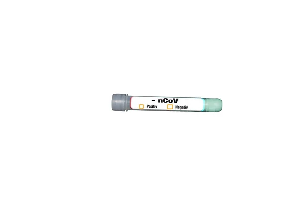 Test Tube Blood Sample Covid Test Novel Coronavirus 2019 Found — Stock Photo, Image