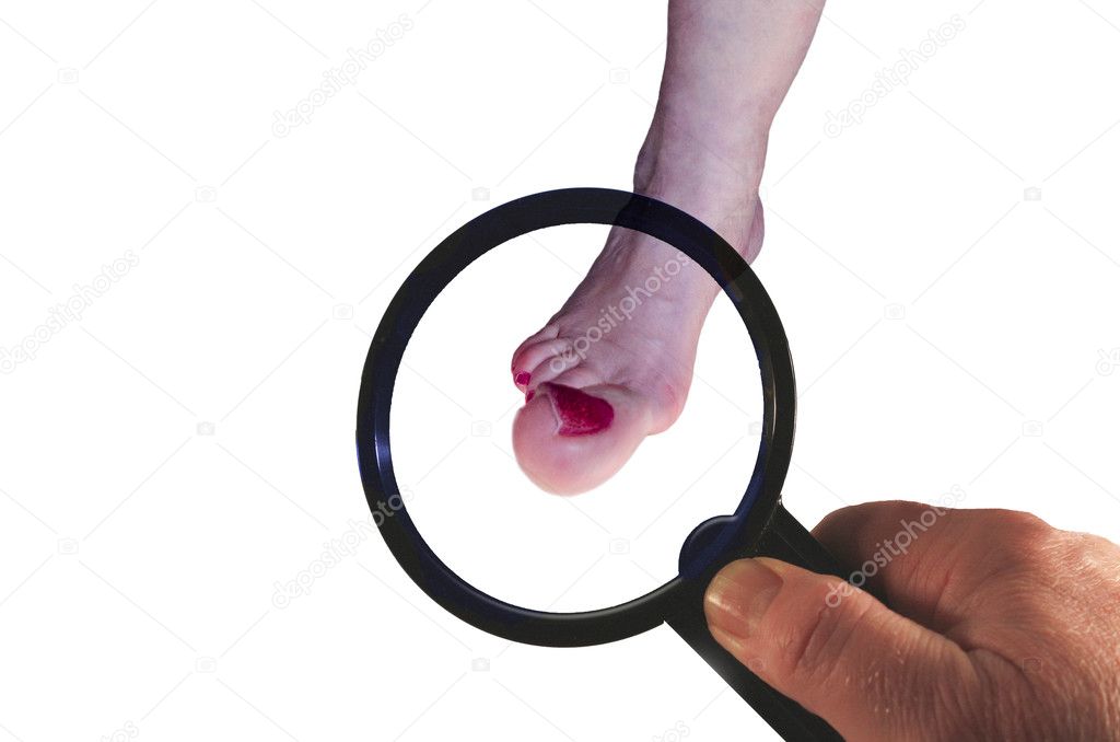 Foot under magnifying glass