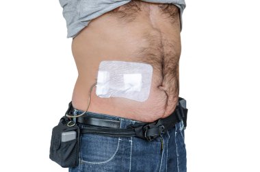 Adamla bir yardımcı cihazlar, yapay Kalpler, Lvad, sol veya teçhizat