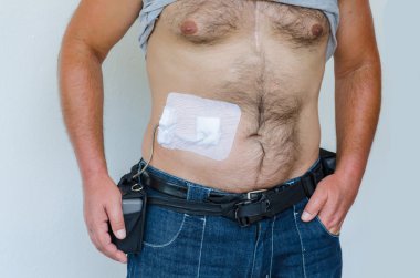 Yapay kalp Lvad,