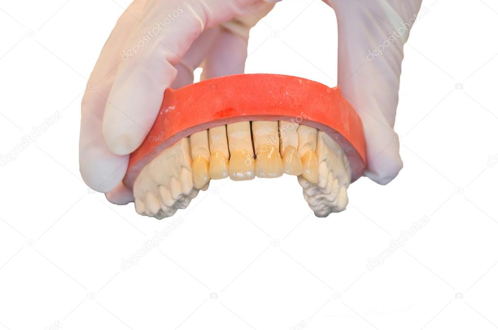 Dentures, prosthesis and oral hygiene. Dentures, prosthesis