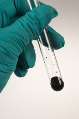 Beyaz bir arka plan üzerinde iğne ile şırınga