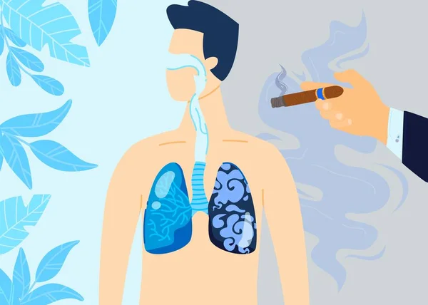 Fumo danni polmonari vettoriale illustrazione, fumetto piatto danneggiato con sigarette alla nicotina, sistema respiratorio del tabacco, poster medico — Vettoriale Stock