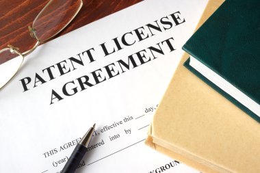 Bir tablo üzerinde patent lisans sözleşmesi. Telif hakkı kavramı.