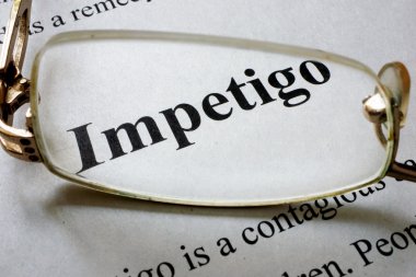 Word Impetigo ile kağıt ve gözlük. Tıp kavramı.