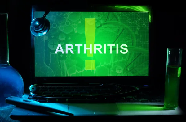 Arthritis — Stock Photo, Image