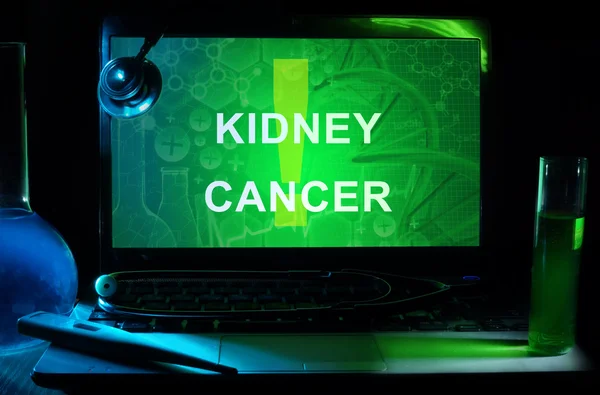 Kidney Cancer — Stock Photo, Image