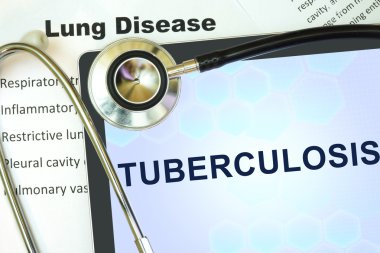 tüberküloz