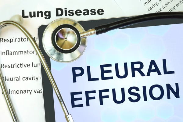 Pleural effusion — Stock Photo, Image