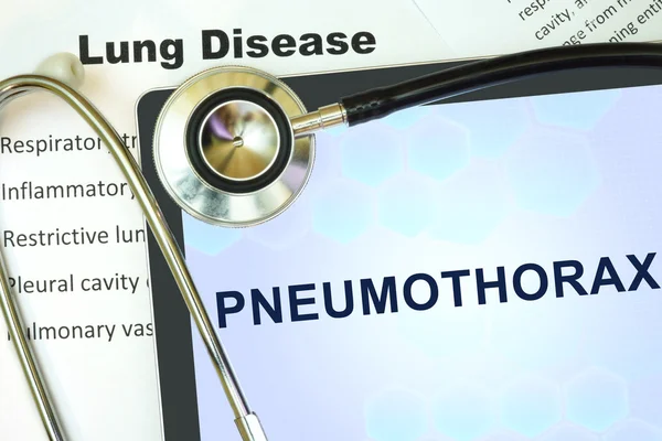 Pneumothorax สหรัฐอเมริก — ภาพถ่ายสต็อก