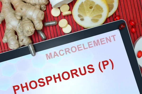 Tablett med ord fosfor (P) — Stockfoto