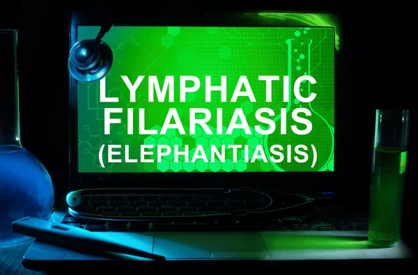 Lymphatische Filariose (Elefantiasis)) — Stockfoto