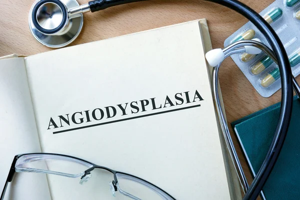 Concetto di angiodisplasia. Libro con stetoscopio e pillole . — Foto Stock