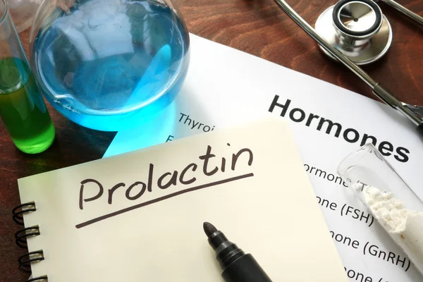 Hormon Prolaktin auf Notizbuch geschrieben. — Stockfoto