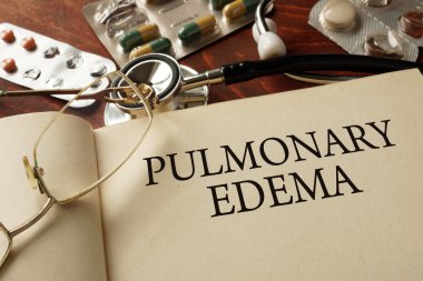 Book with diagnosis Pulmonary edema. clipart