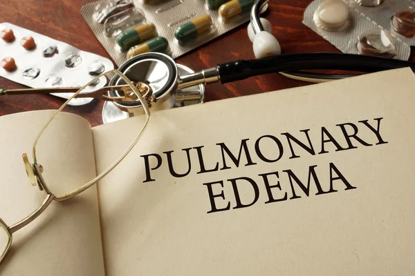 Book with diagnosis Pulmonary edema. — Stock Photo, Image