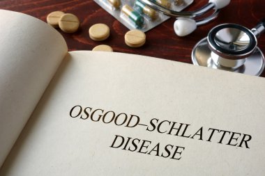 Book with diagnosis Osgood Schlatter disease and pills. clipart
