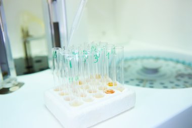 bırakma örnek bir test tüpüne pipet, bilim arka plan