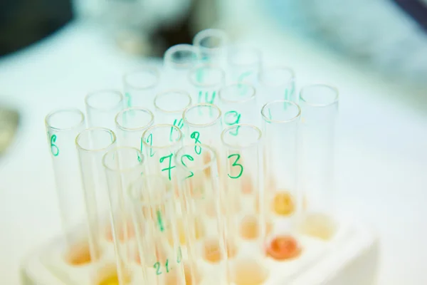 Pipeta dejando caer la muestra en un tubo de ensayo, fondo de ciencia abstracta — Foto de Stock