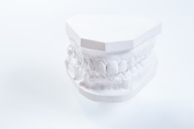 Gypsum model of human jaw on a white background. clipart