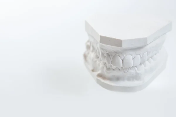 Gypsum model of human jaw on a white background. — Stock Photo, Image