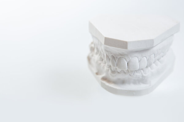 Gypsum model of human jaw on a white background.