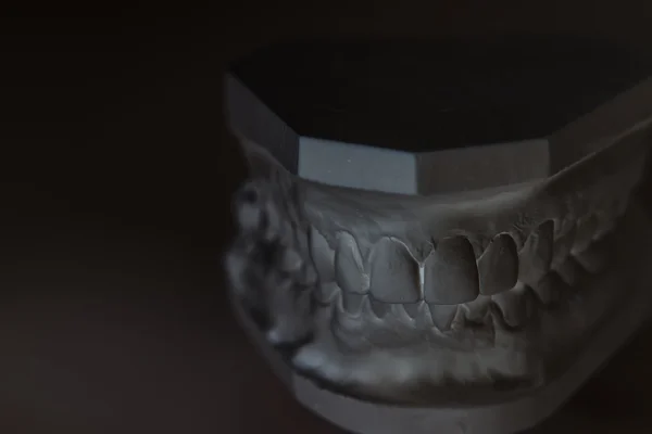 Gypsum model of human jaw on a white background. — Stock Photo, Image